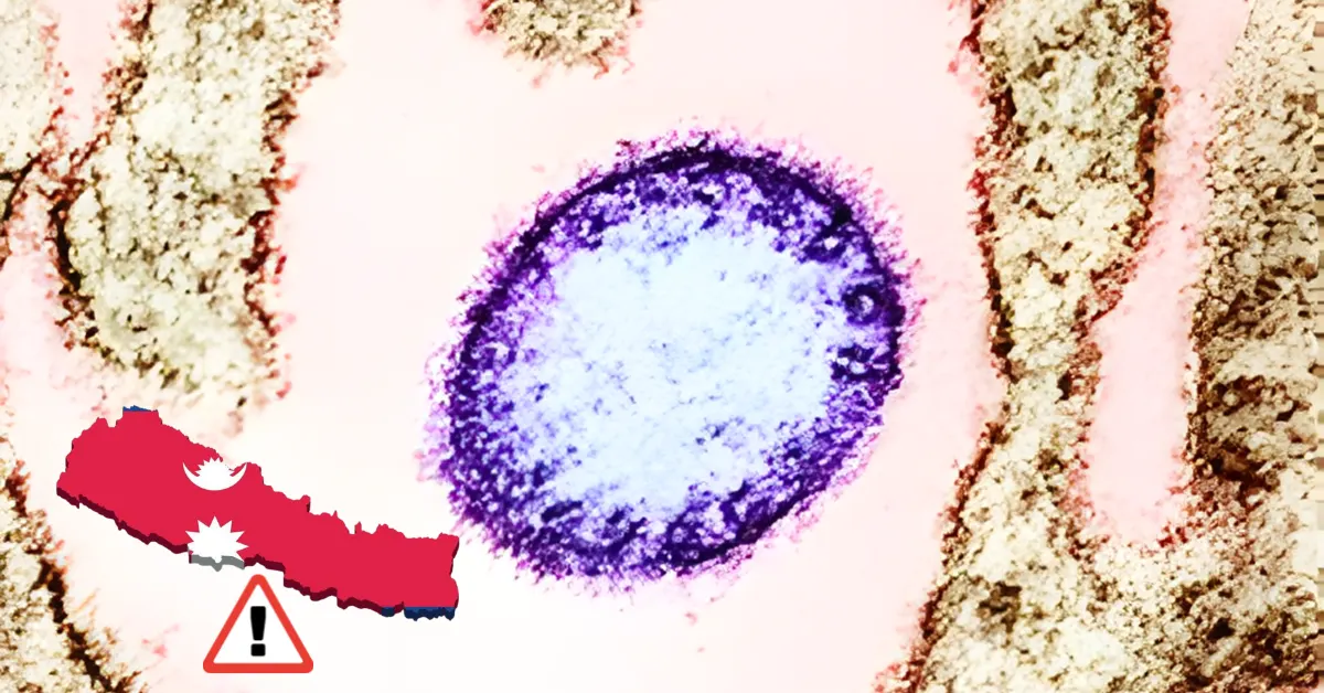 Health screening at Nepal–India border after Nipah virus outbreak in West Bengal